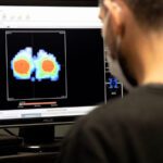Comenso delle asimmetrie - Test Biomeccanico Sessantallora